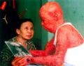 Dioxin - The pain of all people
