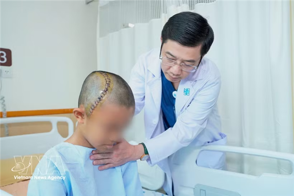 胡志明市医药大学附属医院完成越南首例儿童清醒开颅手术