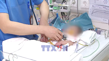 Le Vietnam progresse dans la chirurgie cardiaque pédiatrique complexe