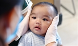 Расщелина губы и нёба: хирурги возвращают улыбки тысячам детей